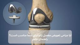 آیا جراحی تعویض مفصل زانو برای شما مناسب است؟ راهنمای جامع