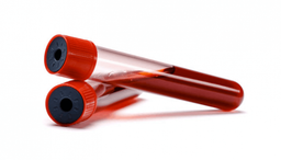 7 آزمایش خون حیاتی که سلامت شما را می‌سازند🩸