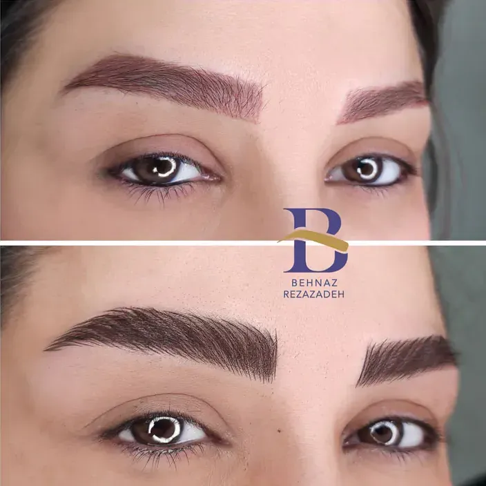 میکروشیفت ابرو