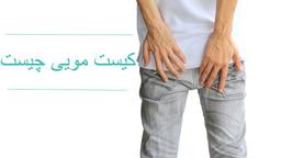 کیست مویی مقعدی چیست؟ علائم، انواع و پیشگیری