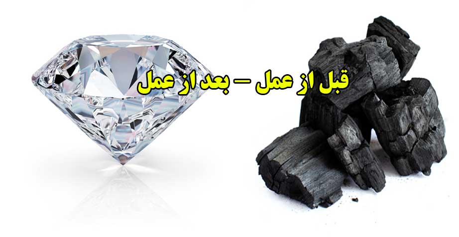 zoghaal
