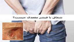 علت بیماری شقاق چیست؟ نحوه معاینه و تشخیص علائم فیشر مقعد