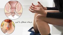 درمان شقاق یا فیشر با لیزر – بهترین راه عمل سرپایی