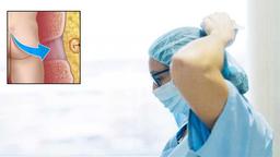 آیا دکتر خوب برای کیست مویی متخصص جراح است؟