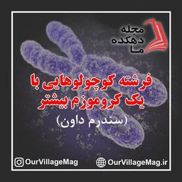 فرشته کوچولوهایی با یک کروموزم بیشتر (سندرم داون)