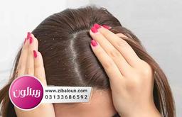 چگونه به رفع شوره سر کمک کنیم؟