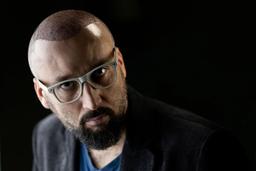 دلایل ایجاد دلمه و زخم بعد از کاشت مو طبیعی