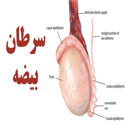سرطان بیضه چیست؟