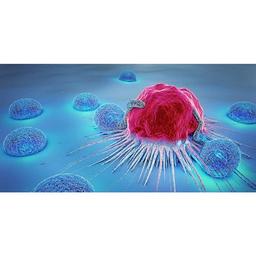 نادرترین نوع سرطان پروستات