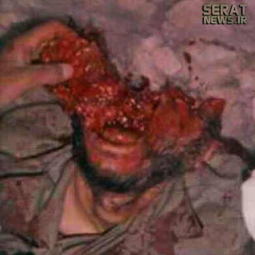 شهید همت موقع شهادت