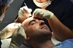 ناگفته هایی درباره کاشت مو در ترکیه