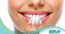 درمان های ترمیمی دندان شامل چه مواردی می شود؟