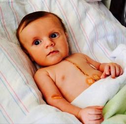 روزهای تاریک و روشن زندگی با سوراخ قلبی[داستان واقعی]