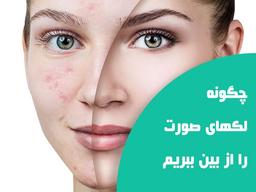 لک صورت چگونه به وجود  می آید