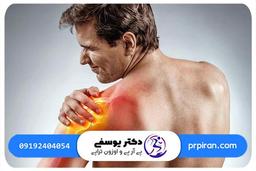 اوزون تراپی درمان قطعی شانه یخ زده