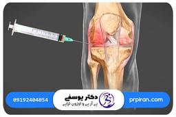 بهبود در زانو با تزریق پی آر پی
