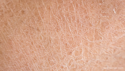 برطرف کردن خشکی پوست: راهکارها و محصولات موثر