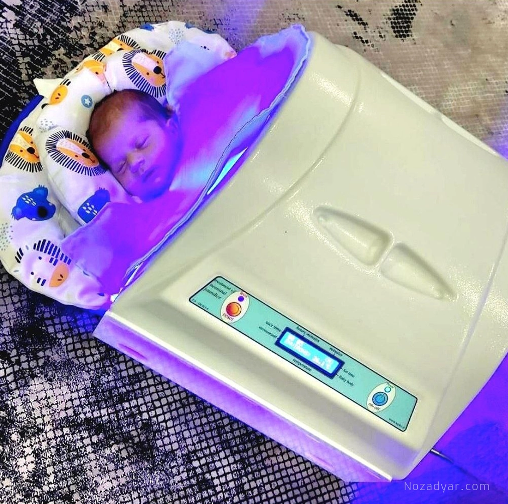 تصویر اجاره دستگاه فتوتراپی در منزل توسط نوزادیار