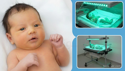 علت اصلی زردی نوزاد + راهکار درمان قطعی