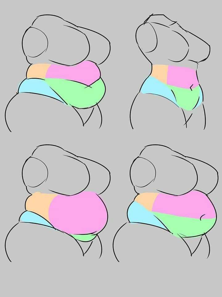 عوارض بعد از عمل اسلیو معده