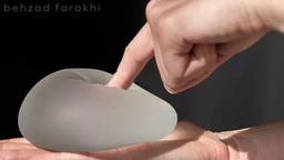 جدیدترین تکنولوژی پروتز سینه 2024