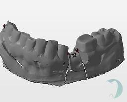 اسکنر دندانپزشکی: انقلاب دیجیتال در دندانپزشکی
