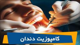 درباره کامپوزیت دندان چی میدونی؟