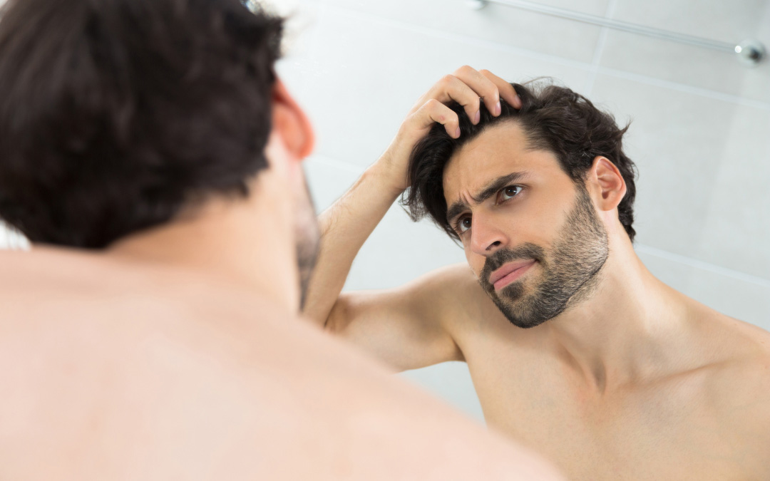 هورمون‌ها در ریزش مو