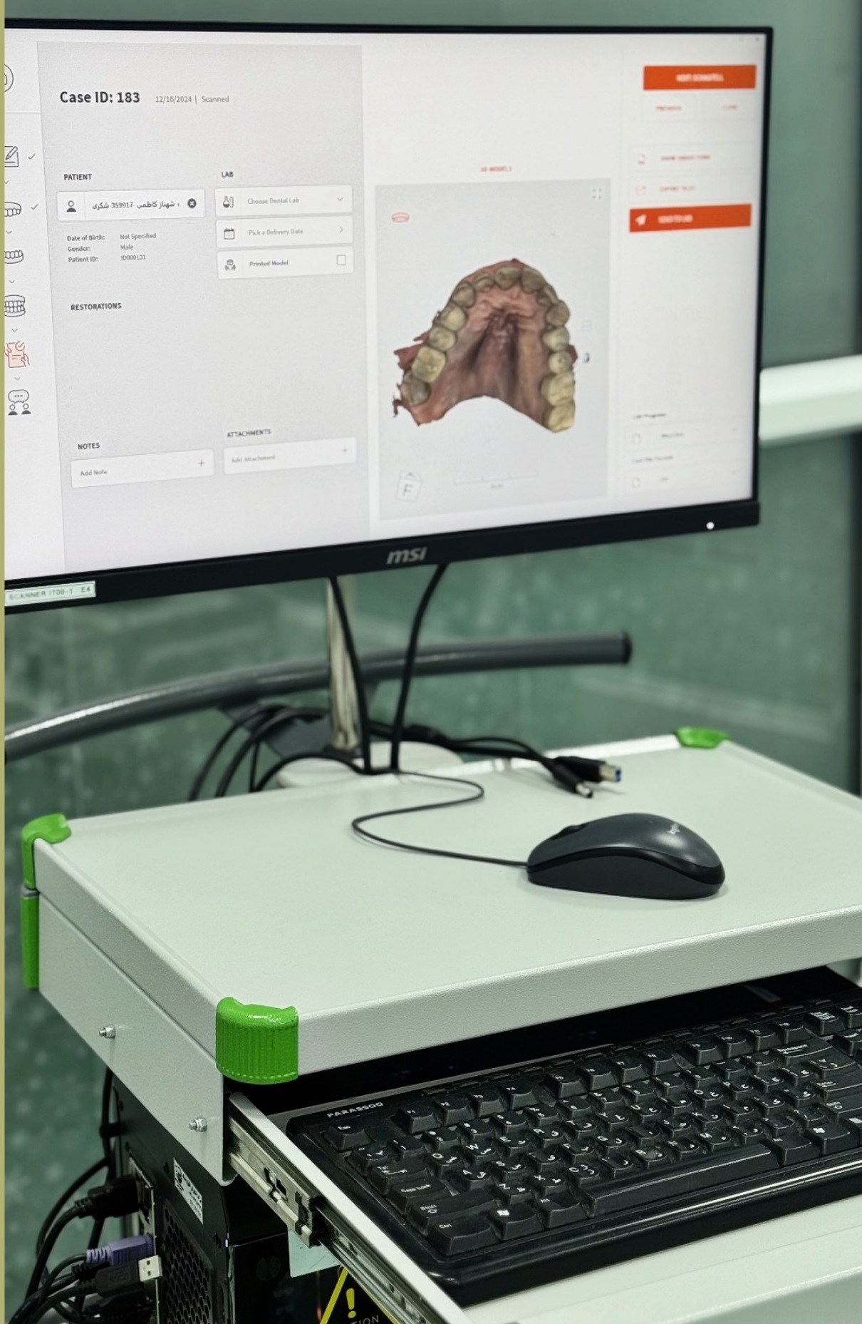 اسکنرهای داخل دهانی