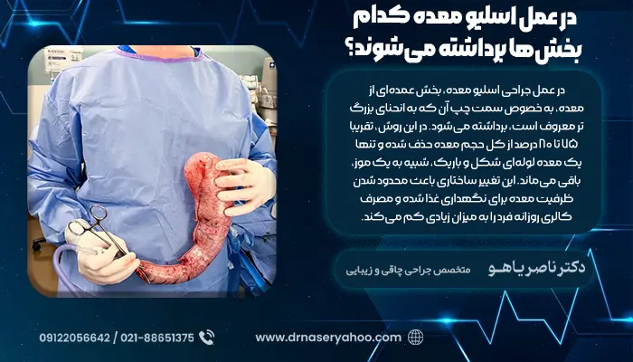 آیا فوندوس در اسلیو برداشته میشود؟