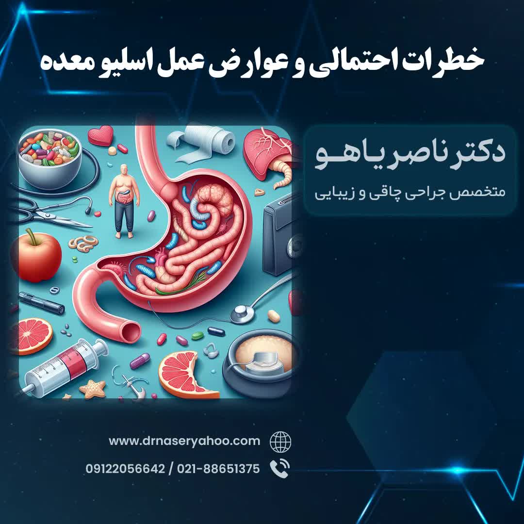 عوارض عمل اسلیو معده