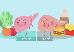 کبد چرب ، عارضه فراگیر زندگی شهرنشینی