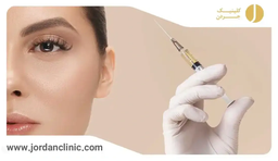 مزایا و کاربرد پروفایلو چیست؟