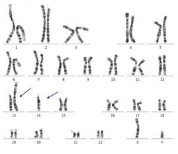 کاریوتایت (karyotype) چیست؟ روش های انجام آن چگونه است؟
