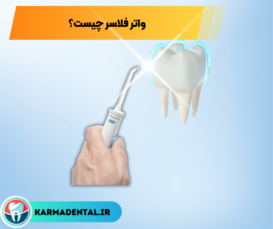 واترفلاسر چیست