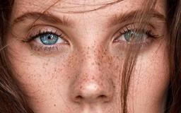 کک و مک چیست و چگونه درمان می‌شود؟