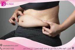 پیکرتراشی چیست و چگونه انجام می شود؟انواع روش ها