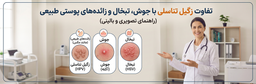 تفاوت زگیل تناسلی با جوش، تبخال و زائده‌های پوستی طبیعی (راهنمای تصویری و بالینی)