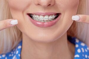 هزینه ارتودنسی: سرمایه‌گذاری برای زیبایی و سلامت