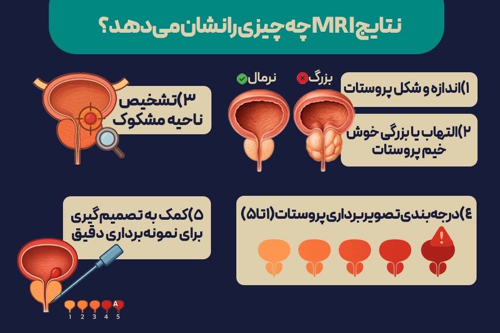 ام آر آی پروستات چگونه انجام میشود؟
