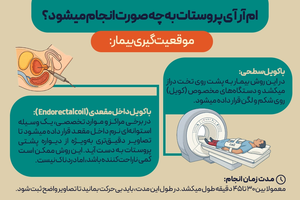 ام آر آی پروستات چگونه انجام میشود؟