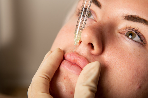 فیلر لب روسی