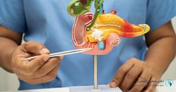 جراحی سنگ کیسه صفرا در تهران