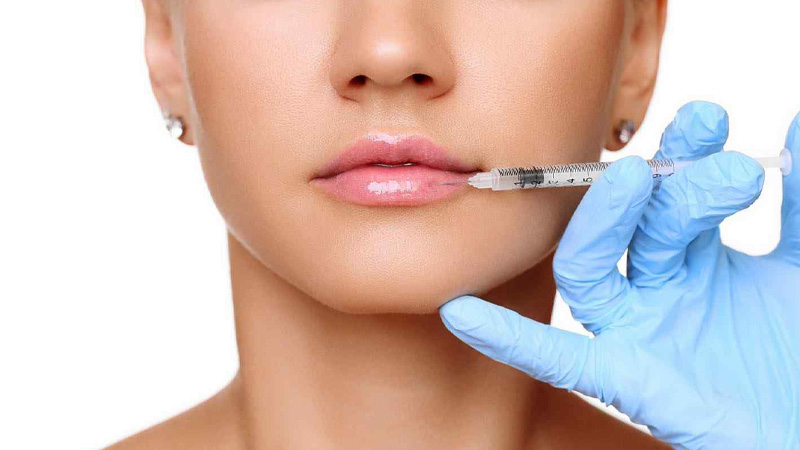 بهترین دکتر تزریق ژل لب روسی در شیراز