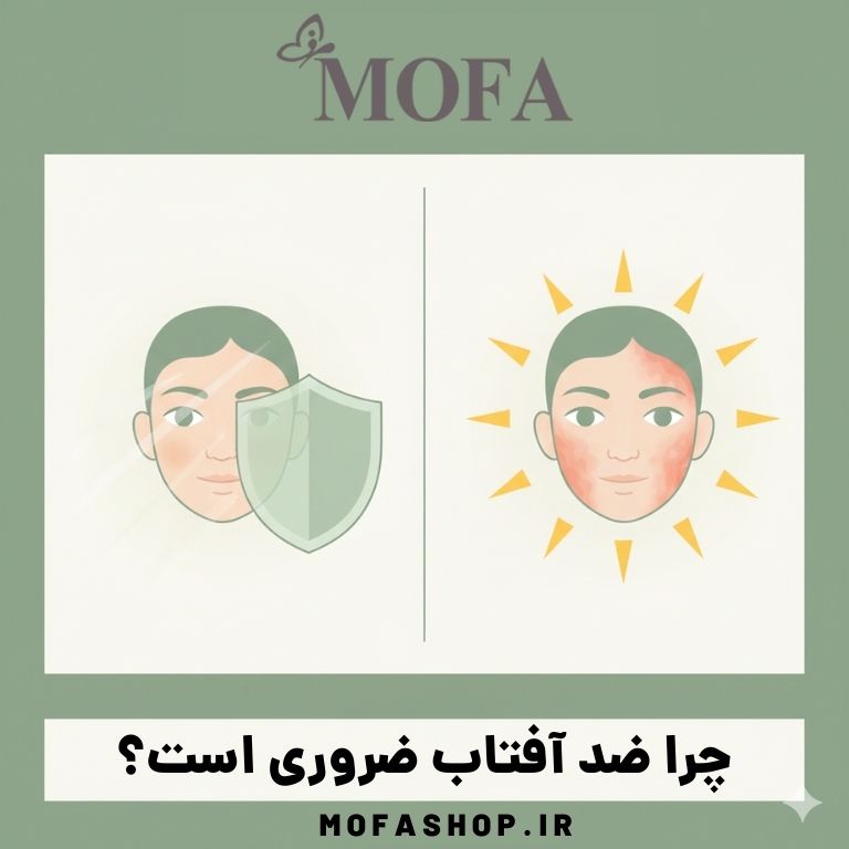 چرا باید از کرم ضد آفتاب استفاده کنیم؟