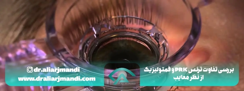 بررسی تفاوت ترنس پی آر کی و فمتولیزیک از نظر معایب