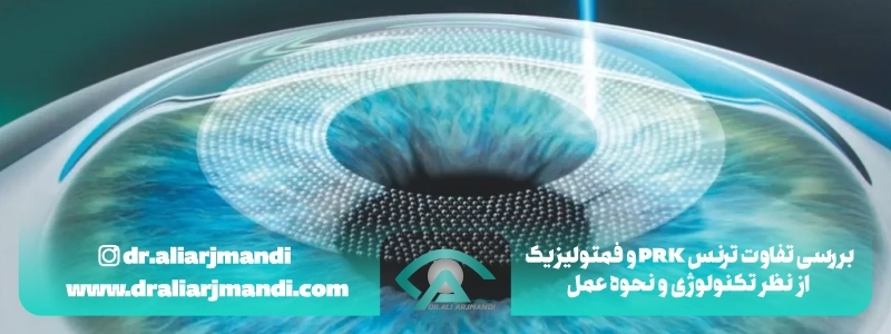 بررسی تفاوت ترنس پی آر کی و فمتولیزیک از نظر تکنولوژی و نحوه عمل