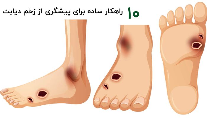پیگیری از زخم دیابت