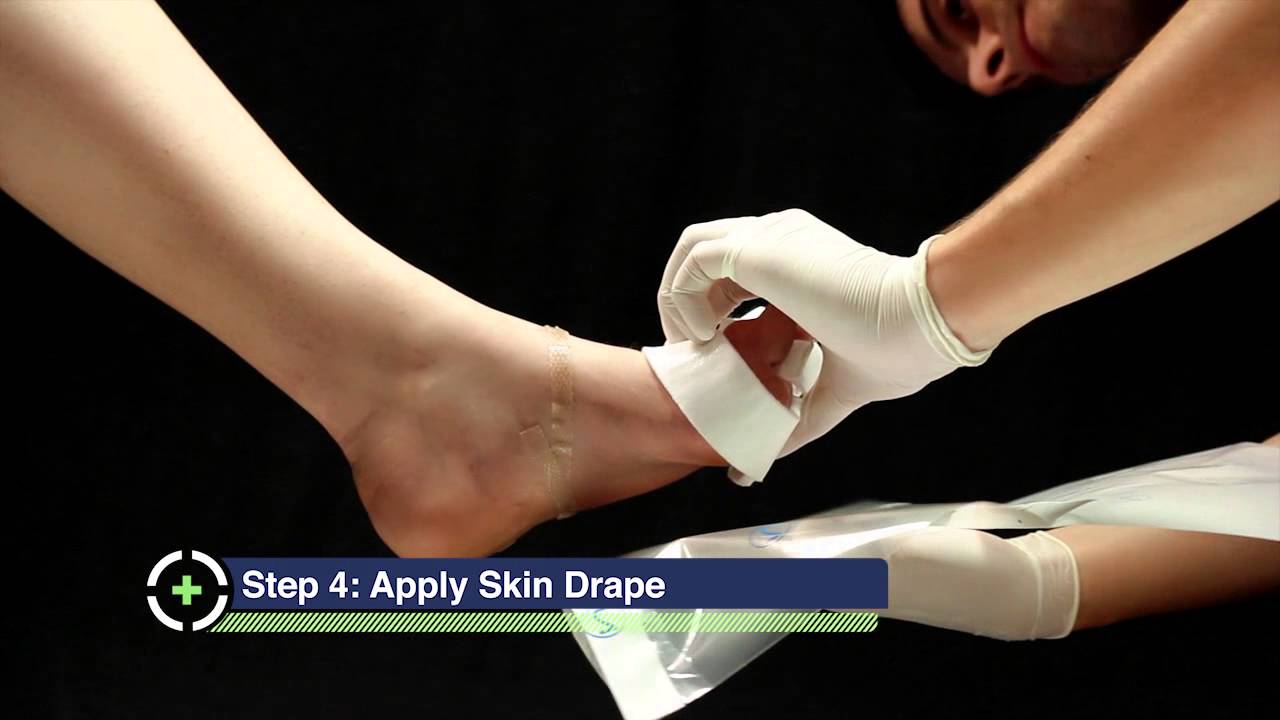 پانسمان های زخم فشاری