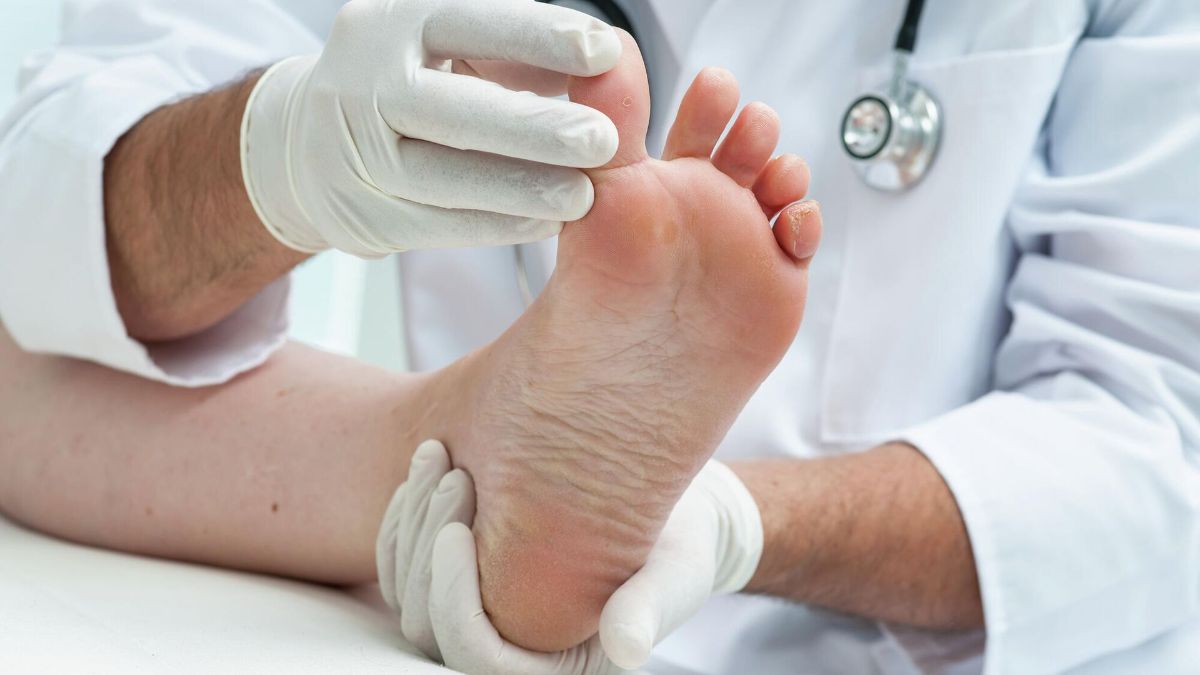 درمان زخم دیابت